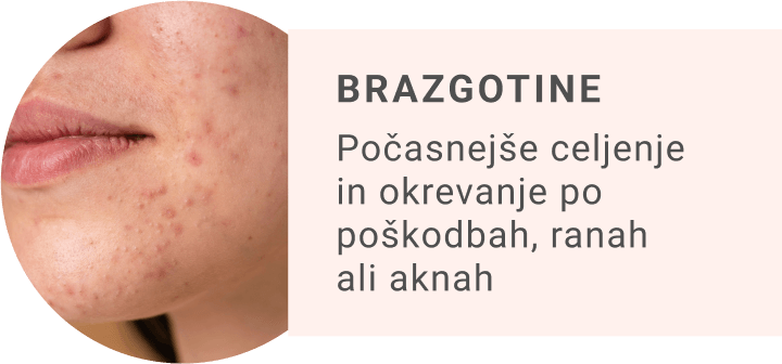 Anti-age krema Mia