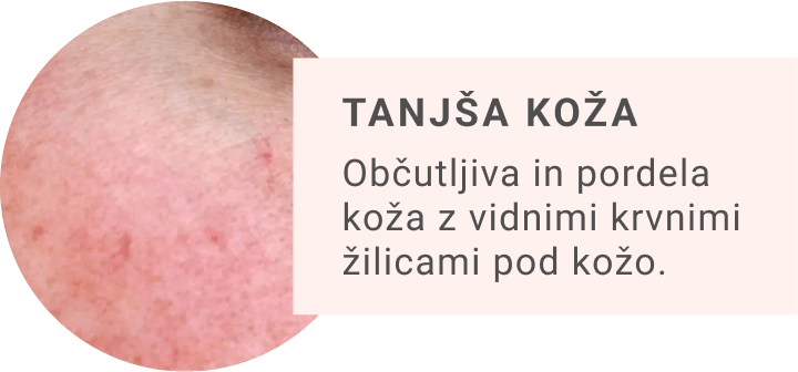 Anti-age krema Mia